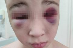 Россиянка обвинила участника спецоперации в избиении 10-летнего сына палками