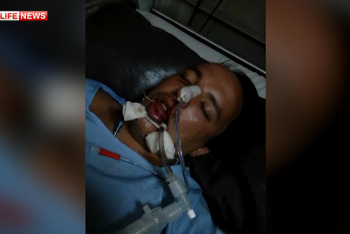 Турист из России впал в кому в госпитале Шарм-эль-Шейха