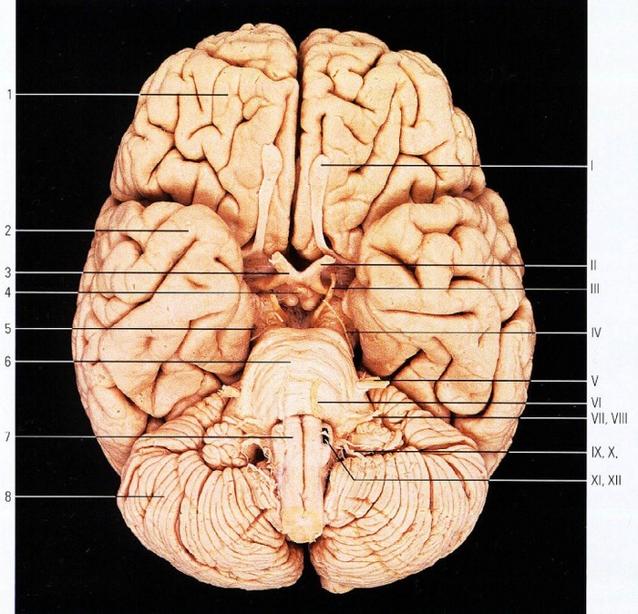 Выход мозга. Черепно мозговые нервы на основании мозга. Черепные нервы на препарате анатомия. Черепные нервы нижняя поверхность головного мозга. Черепные нервы анатомия Синельников.