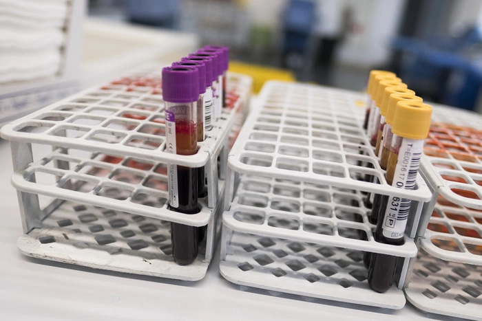 Врачу из Екатеринбурга грозит до трех лет тюрьмы за смерть пожилой пациентки