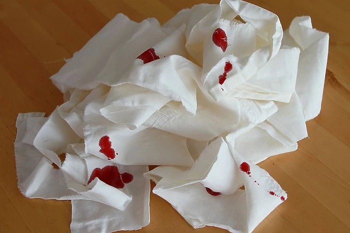 Незнакомец напал с ножом на мужчину в Академическом районе (ФОТО)