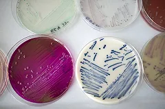 В России нашли «неуязвимые» штаммы стафилококка