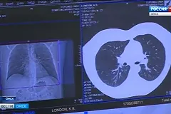 Показания для проведения КТ ужесточились в Свердловской области