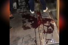 В Екатеринбурге мужчина залил кровью трамвай