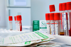 По России распространяется новая, очень живучая форма ВИЧ