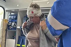 Екатеринбурженка пробила телефоном голову пенсионерке из-за просьбы убрать за собакой