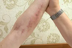 В квартире погибшей пары, где спасли двух маленьких детей, нашли метадон