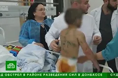 Анонсированы «тяжелые решения» для изувеченной девочки из Ингушетии
