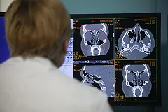 Средняя зарплата врача в Екатеринбурге — 75 тысяч рублей