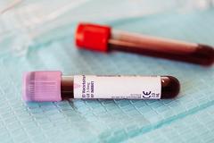 Эпидемиолог объяснил, почему тесты на коронавирус ошибаются в половине случаев