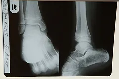 В Волгограде детский врач сядет на десять лет за торговлю спайсами