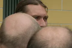 Екатеринбуржцы лысеют чаще, чем жители Москвы и Питера. «В Сочи надо переезжать»