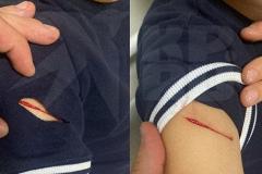 В ЖК «Малевич» в Екатеринбурге 8-летний мальчик порезал ножом другого ребенка