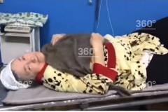 Российские врачи примотали пенсионерке швабру к сломанной ноге и отправили домой