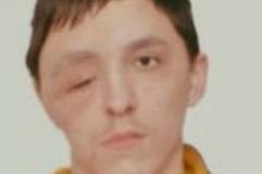 В Свердловской области больше двух недель ищут 18-летнего парня с деформацией лица