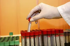 Врачи ОДКБ № 1 рассказали об отравлении 8-летнего мальчика варфарином