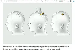 Маск рассказал, как будут вживлять чипы в черепа для подключения мозга к компьютеру