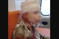 В Каменске-Уральском дети бутылкой разбили голову мальчику