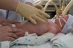 В Когалыме расследуют смерть ребенка из-за врачебной ошибки