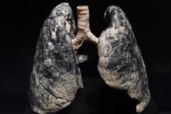 Ученые рассказали о «волшебном» излечении легких курильщиков со стажем