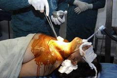 В Китае впервые успешно пересадили человеческую голову