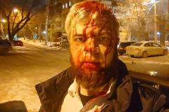 В Челябинске напали на адвоката известного екатеринбургского журналиста