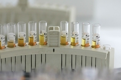 Заболеваемость пневмонией растет в Свердловской области