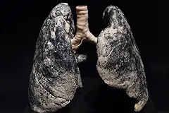 Ученые нашли продукты, восстанавливающие легкие курильщика