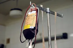 Жители Екатеринбурга смогут бесплатно пройти проверку на свертываемость крови