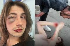 Екатеринбургского туриста избили в Сочи из-за длинных волос