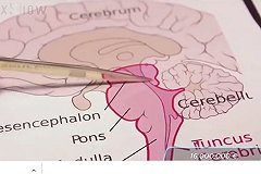 В Екатеринбурге будут судить хирурга, умышленно перерезавшего пациентке путь к зачатию