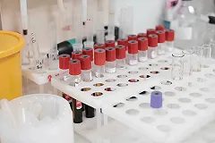 На Урале медики усилили контроль за лечением пациентов с хроническими психическими расстройствами