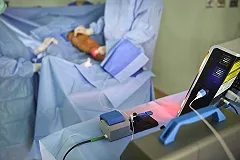 Физики МФТИ разработали надежный и дешевый лазерный скальпель на основе керамики