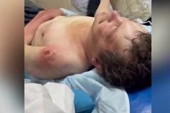 Свердловских врачей обвинили в том, что они бросили пациента умирать