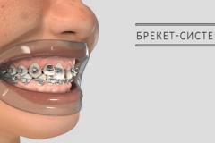 Главный стоматолог России сравнил услуги стоматологических клиник с «МММ»