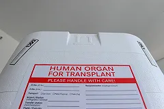 Умершая от укола лидокаина девочка ждала трансплантации почки