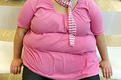 Минздрав назвал страдающие от ожирения регионы