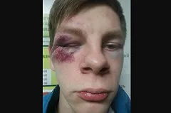 Мать жителя Новоуральска, которого избили из-за бутылки воды, рассказала о деталях происшествия