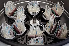 Родные погибшей пациентки отсудили у екатеринбургской больницы 750 тыс. рублей