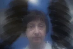 В субботу, 23 марта, в Екатеринбурге можно будет бесплатно пройти флюорографию