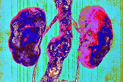 Рак заморозили и убили. Такого в России еще никто не делал