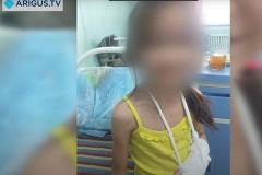Мать отрезала 8-летней дочери пальцы за игру со спичками