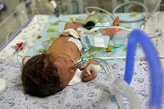 Полуторагодовалая девочка отравилась спайсом на Южном Урале