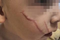 «Брякнуть её»: свердловской воспитательнице детсада, в котором малыш порезал лицо, начали угрожать