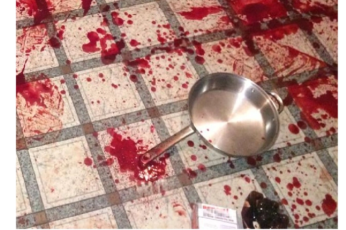 Свердловчанин убил своего брата из-за спора про уход за садом