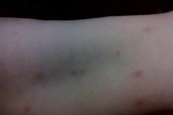 Эксперты рассказали, чем можно заразиться после купания в свердловских водоёмах