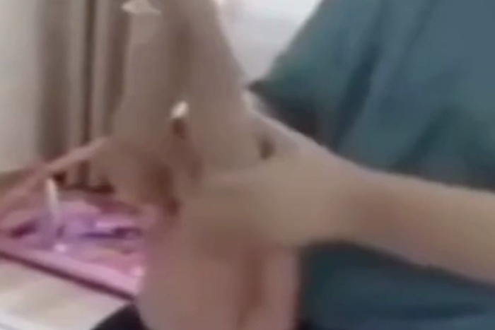 В Новосибирске массажист выкручивал голову грудничку на 180 градусов