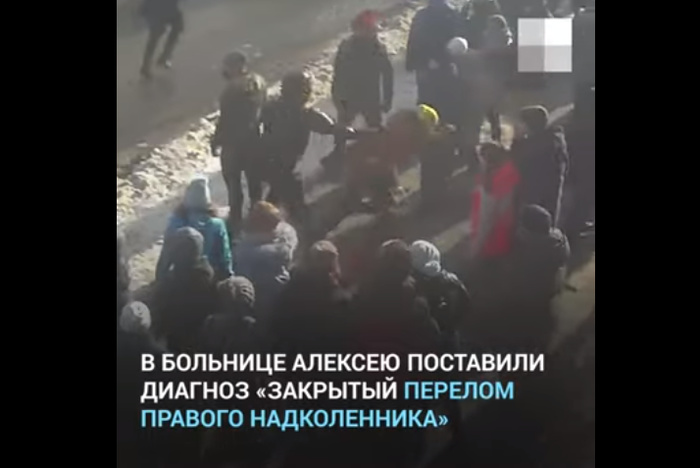 СК не будет проверять действия полицейских, травмировавших двух челябинцев на митинге Навального