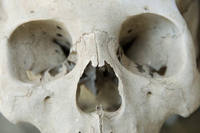 ДНК-анализ подтвердил личность мужчины, чей скелет нашли в лесу вместе с фото