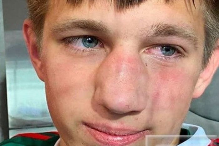 Футболисты юношеского клуба избили игрока «Локомотива»